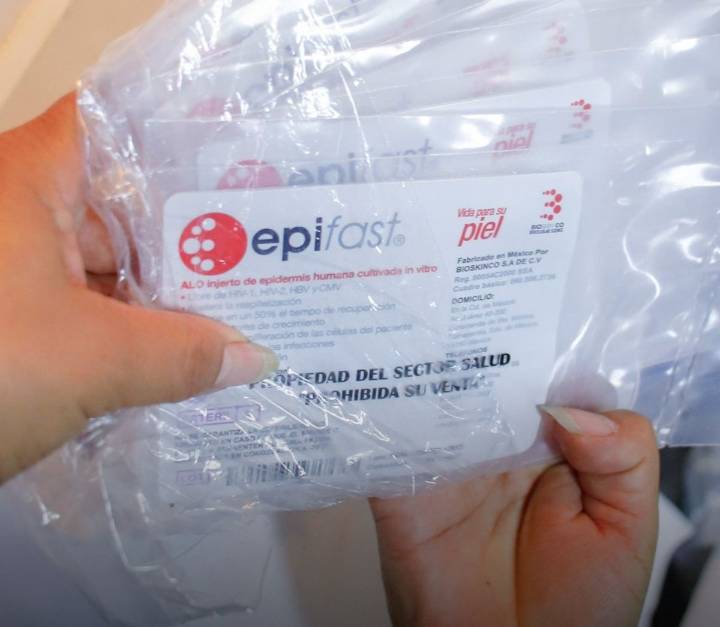 IMSS-Bienestar aplica tratamiento biotecnológico a pacientes quemados en Iztapalapa