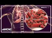 TB case reported at East Lincoln High School