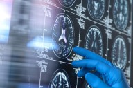 Overweight and inactive? New study suggests it could impact your brain health