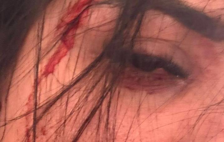 Brutal paliza en Zaragoza: una mujer pega a otra por unos mensajes de Whatsapp que envió a su novio