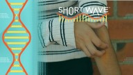 A surprising food allergy culprit : Short Wave : NPR