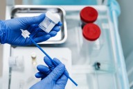 Nonadherence to Cervical Cancer Screening Increased After COVID