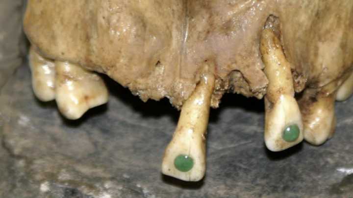 Los mayas se atrevieron a incrustar gemas de jade incluso en dientes de niños de apenas siete años como símbolo de madurez social