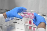 Dengue: un enemigo pequeño pero peligroso