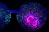 NIH Funds New Autism Studies on Genes and Environment as Trump Focuses on Tylenol