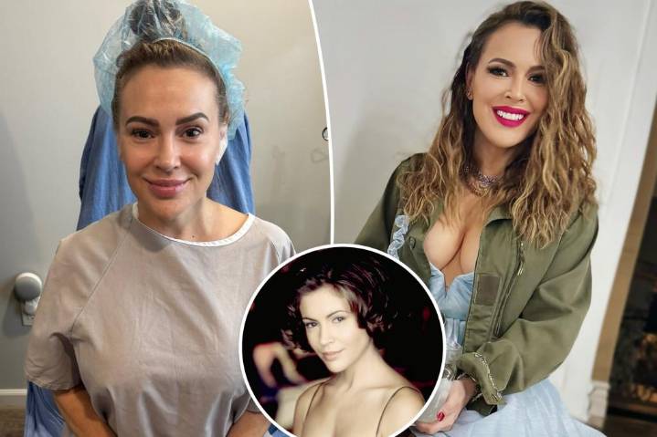 Alyssa Milano removes breast implants to let go of body that was 'sexualized' and 'abused'