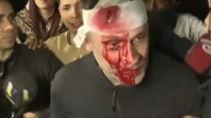 Agredieron a periodista de América TV en el acto de Javier Milei en Moreno