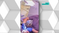 Polémica en EEUU por el trato denigrante de una dentista trumpista a sus clientes: "Si no les gusta Trump les reduzco la anestesia"