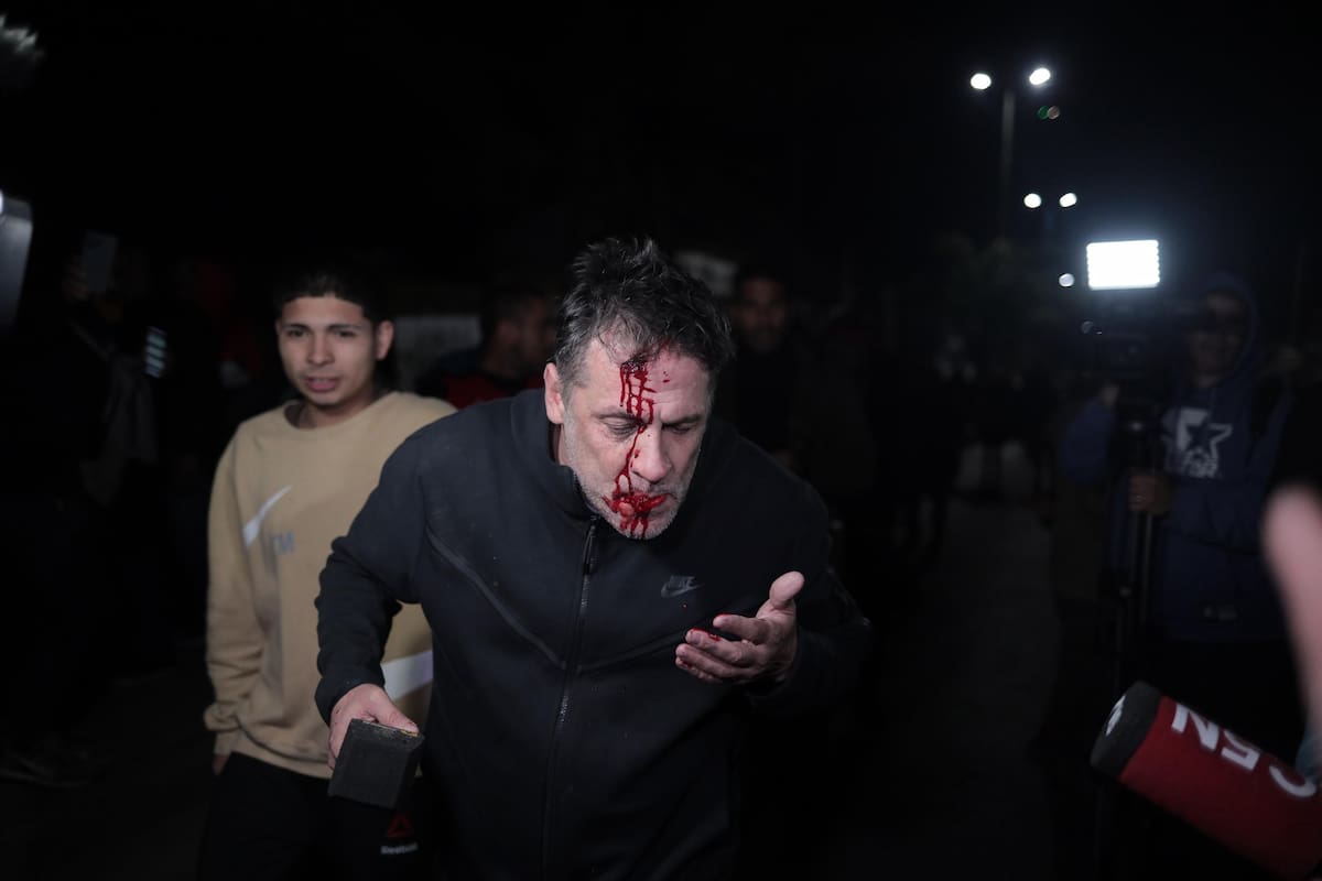 Cristian Mercatante. Quién es el periodista al que le tiraron una botella en la cabeza durante el cierre de campaña de Milei