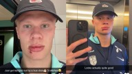 Erling Haaland requires stitches after Norway 'bus door' incident
