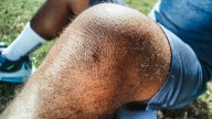 My knee is clicking. Should I be worried? Am I getting arthritis?