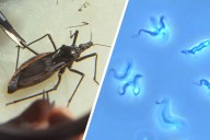 What is Chagas Disease? The Scary Truth About the ‘Kissing Bug’ Parasite Spreading in the US (Video)
