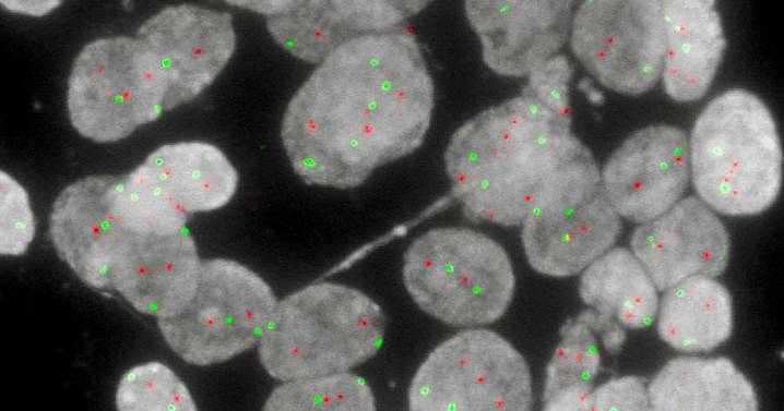 Desarrollan una 'caja negra' para descifrar el origen y la evolución de cada cáncer