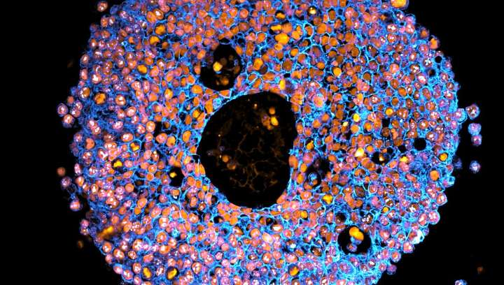 Scientists Successfully 3D Bioprinted Miniature Placentas – And It Could Transform Pregnancy Research