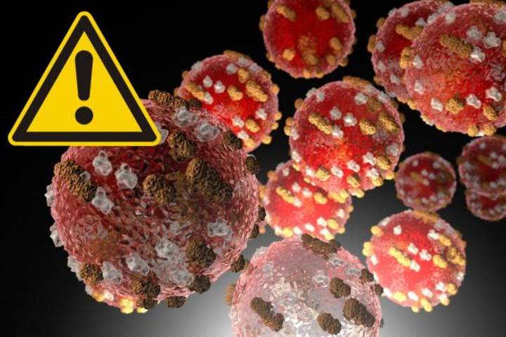 Measles Cases Climb In New Jersey With New Exposure Warnings