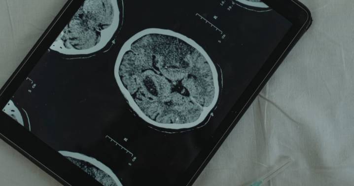 Tres factores de riesgo clave para padecer Alzheimer: hipertensión, obesidad y diabetes, dice Ssa