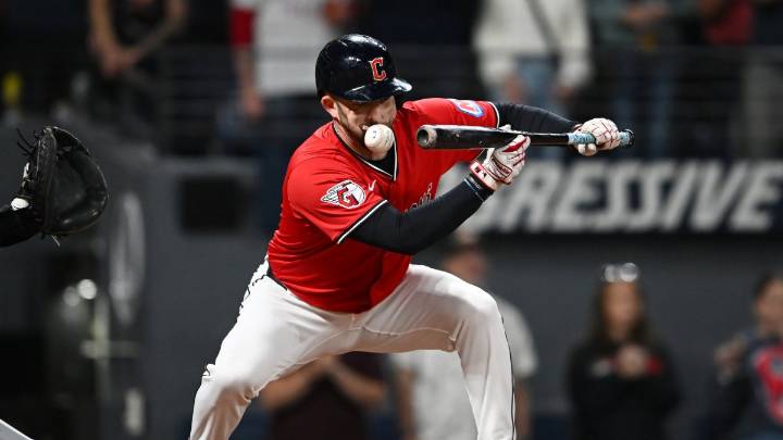 Guardians' David Fry hospitalized after being hit in face by pitch vs. Tigers