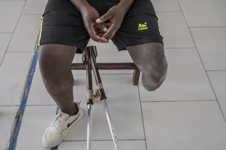 On the front line of Congo’s conflict, a trauma center tells a story of horror and survival