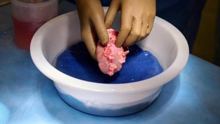 La FDA autoriza los ensayos de trasplantes de riñón de cerdo en humanos