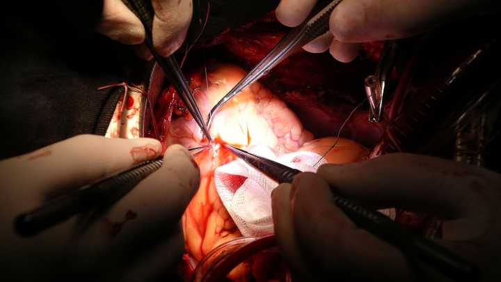 El Hospital Reina Sofía de Córdoba supera los 800 trasplantes de corazón en casi 40 años
