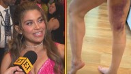 Danielle Fishel Shares 'Dancing With the Stars' Injury Update (Exclusive)