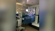 3D tech helps save Utah teacher’s kidney