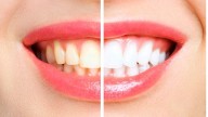 La razón por la que se nos ponen los dientes amarillos, según una ortodoncista: "No siempre es por..."
