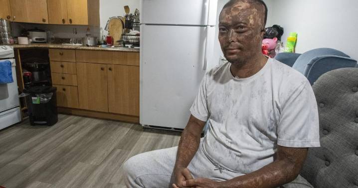 How a surgeon gave a Hamilton dad his voice back