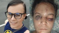 25-year-old man pleads not guilty to violent assault on trans woman