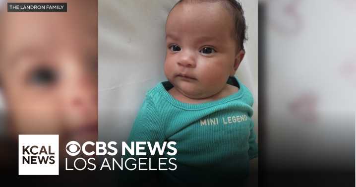 LA County baby receives life-changing implant after isolating for a year