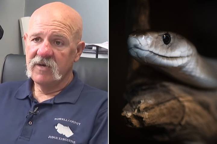 EMTs Under Fire for Treating Man with Antivenom After He Was Bitten by Snake