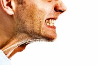 Estrés, ansiedad  y mala oclusión son algunas de las causas del bruxismo