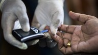 Neglected form of diabetes with unusual symptoms finally gets its own name