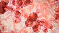 Treatment-resistant fungus cases rising in Kansas: KDHE