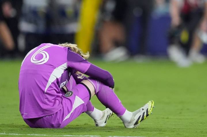 Union have four days to stop the slide after Open Cup ouster in Nashville