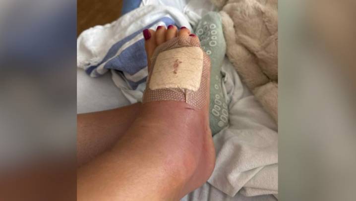 'Just thankful to be here': Alabama woman hospitalized over rare flesh