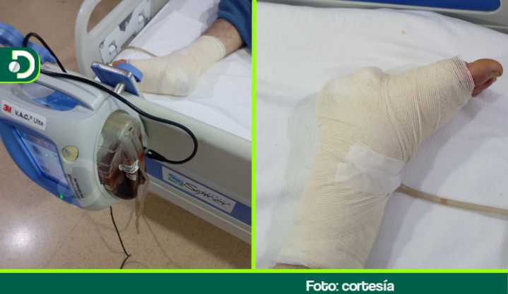 En Rionegro, un joven lleva 27 días esperando una cirugía para salvar su pie: Eps no autoriza