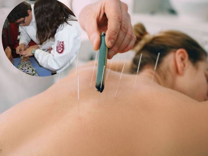 Cómo sacar cita en la clínica de acupuntura del IPN