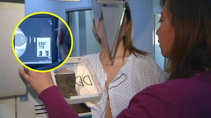 Completamente gratis: Ministerio de Salud incorpora primera inmunoterapia contra el cáncer de mama