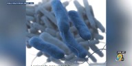 ‘I just want to know how this happened’: Wife of Legionnaires’ disease patient speaks out