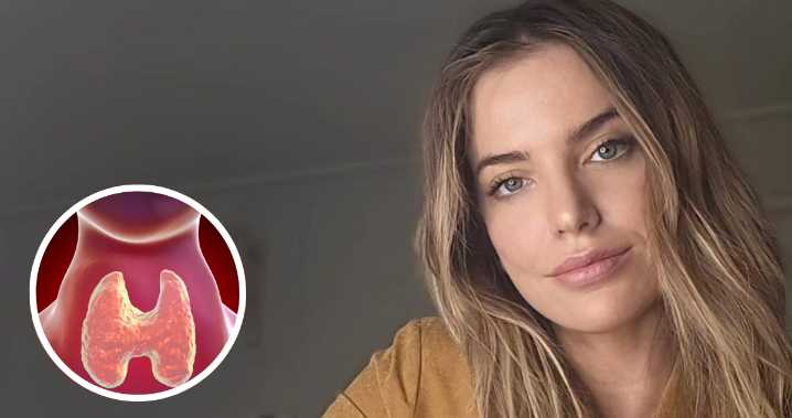 Millaray Viera se sincera tras confesar que sufre enfermedad en la tiroides: "Hace peligrar tu vida"