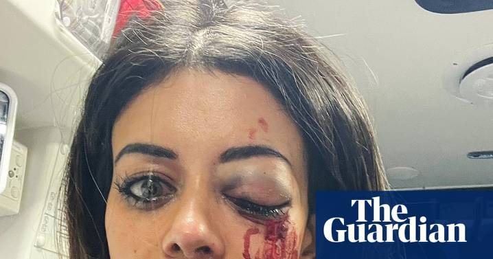 Police officer charged with assault after Hannah Thomas injured at pro