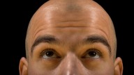 What you eat and drink can contribute to your hair loss