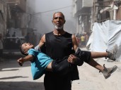 Foreign doctors say Israel systematically targeting Gaza’s children: Report