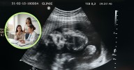 Desabasto de fármacos obliga a usar legrado en el 38% de los abortos legales