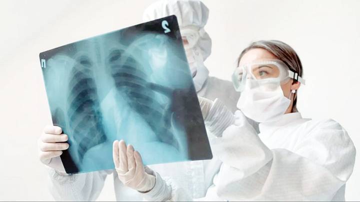 Se disparan casos de tuberculosis en Nuevo Laredo; IMSS Bienestar registra aumento del 30%