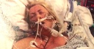 Woman's fingers and toes fell off after hospital sent her home with pills
