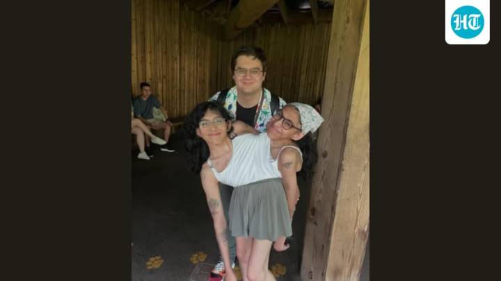 Woman on navigating conjoined twin's intimacy in marriage: ‘I have headphones'
