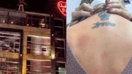 Andrés Carne de Res: ¿a qué consecuencias se enfrenta el famoso restaurante tras quemaduras que sufrieron clientes en Bogotá?