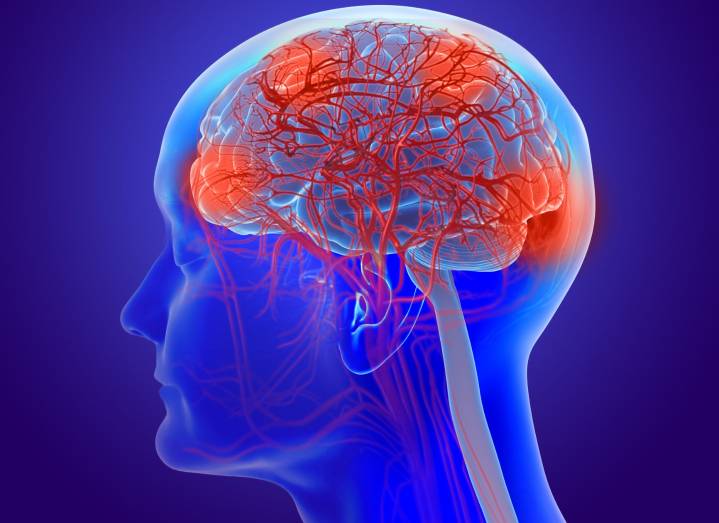 Aging and Alzheimer’s Linked to Changes in Brain’s Microvasculature